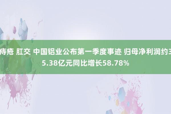 痔疮 肛交 中国铝业公布第一季度事迹 归母净利润约35.38亿元同比增长58.78%